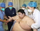 Berat Badan Seorang Pria di Wuhan, China, Naik 101 Kilogram Dalam 5 Bulan Akibat Lockdown