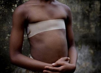 Ini Alasan Wanita di Afrika Setrika Payudaranya Dengan Batu Panas
