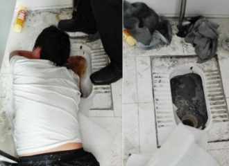 Miris! Demi Selamatkan iPhone, Tangan Pria Ini Terjebak di Kloset