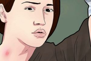 Remaja Terkena Stroke Setelah Di Cupang Pacar