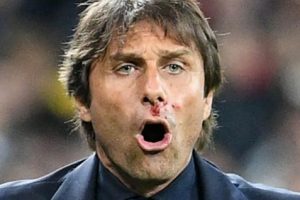 Inilah Penyebab Hidung Conte Mengeluarkan Darah