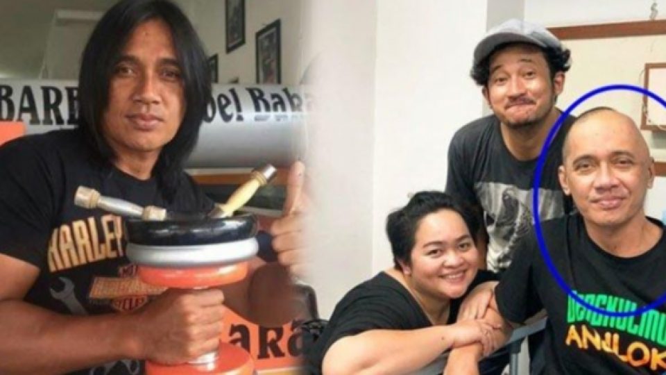 Lama Tak Ada Kabar, Ternyata Agung Hercules Berjuang Melawan Kanker Otak Stadium 4