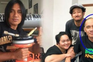 Lama Tak Ada Kabar, Ternyata Agung Hercules Berjuang Melawan Kanker Otak Stadium 4