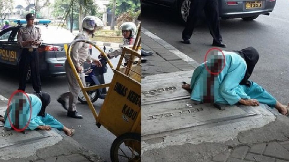 Nenek di Sidoarjo Berjalan Dengan Pisau Tertancap di Punggung 
