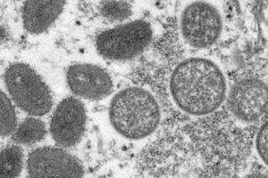 Kasus Penyebaran Virus Cacar Monyet Telah Ditemukan di Eropa dan AS