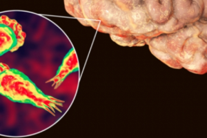 Korsel Laporkan Kasus Kematian Pertama Warga Negaranya Akibat Amuba Pemakan Otak