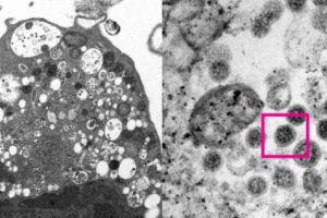 Kementerian Kesehatan Bantah Varian Omicron Terdeteksi di Cikarang