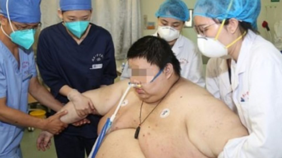 Berat Badan Seorang Pria di Wuhan, China, Naik 101 Kilogram Dalam 5 Bulan Akibat Lockdown