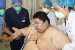 Berat Badan Seorang Pria di Wuhan, China, Naik 101 Kilogram Dalam 5 Bulan Akibat Lockdown